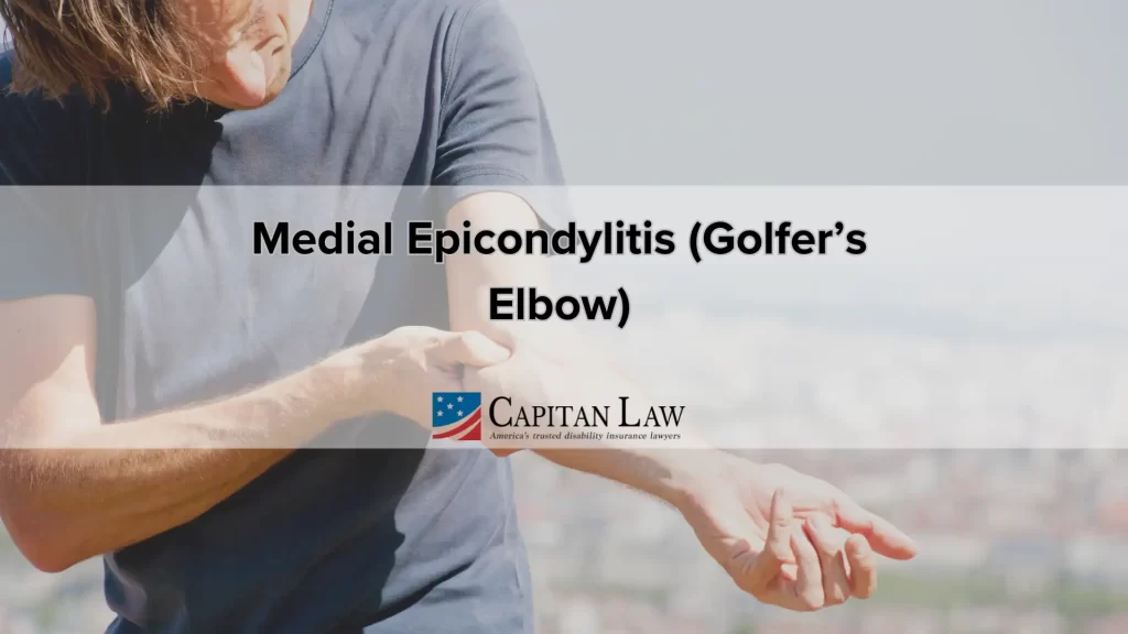 Medial Epicondylitis (Golfer’s Elbow)